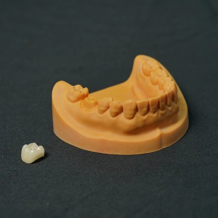 Zirconia Crown Finished